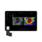 NTE (Natural Touch Elastography), MEDLIGA NTE (Natural Touch Elastography)