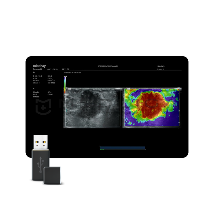 NTE (Natural Touch Elastography)